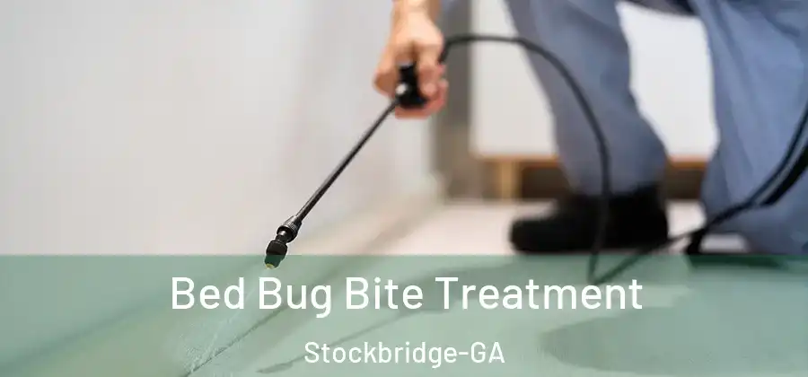 Bed Bug Bite Treatment Stockbridge-GA
